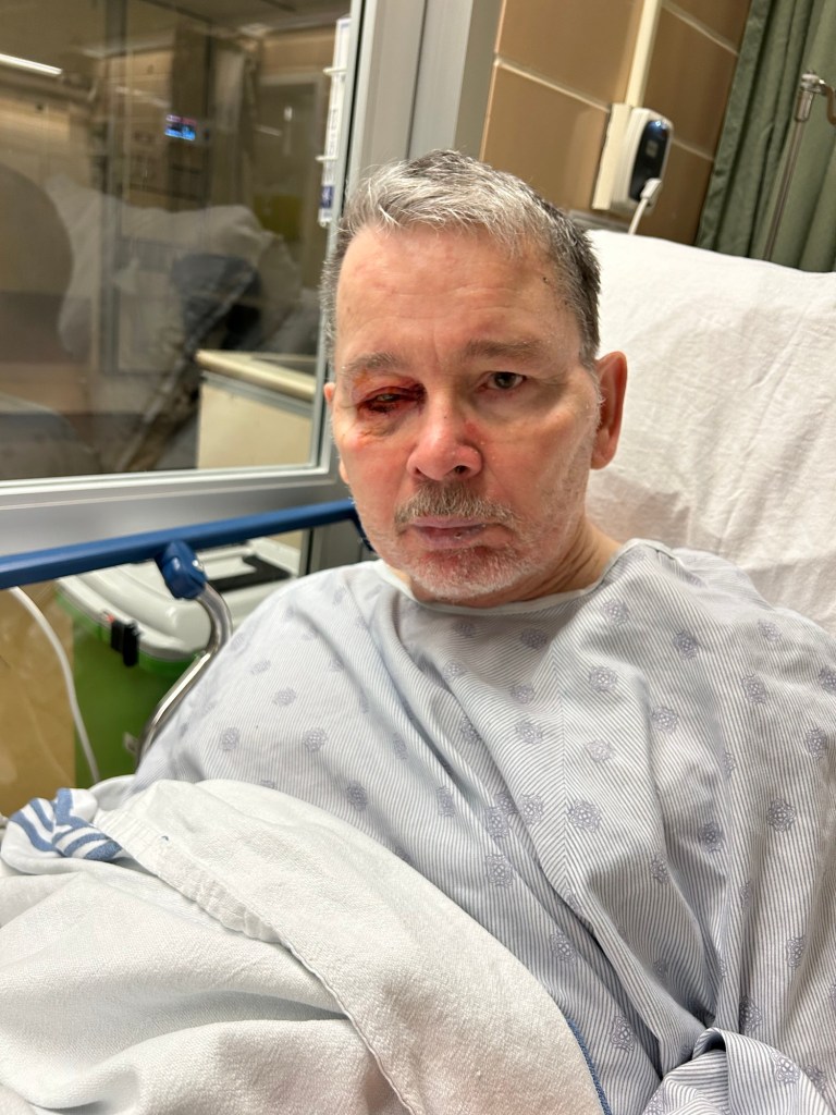 John at Hôpital Notre Dame after nasty fall